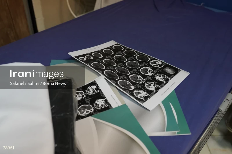Organ donation surgery in Masih Daneshvari hospital