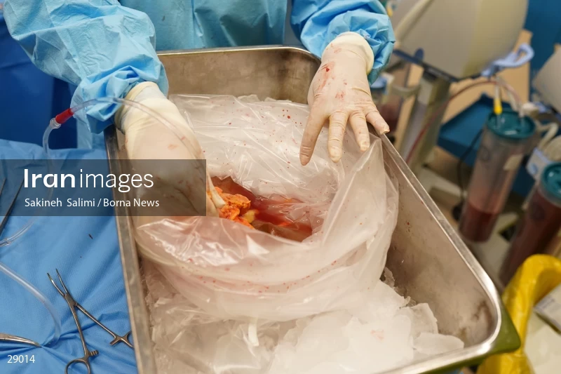 Organ donation surgery in Masih Daneshvari hospital